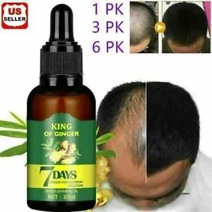 [10807 sold]Regrow 7 Day Ginger Germinal Hair Growth Serum Hairdressing Oil Loss Treatment